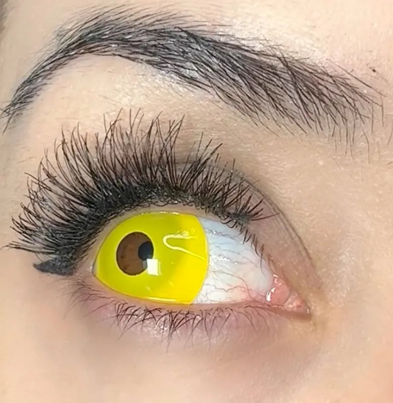 17 mm Glow Yellow