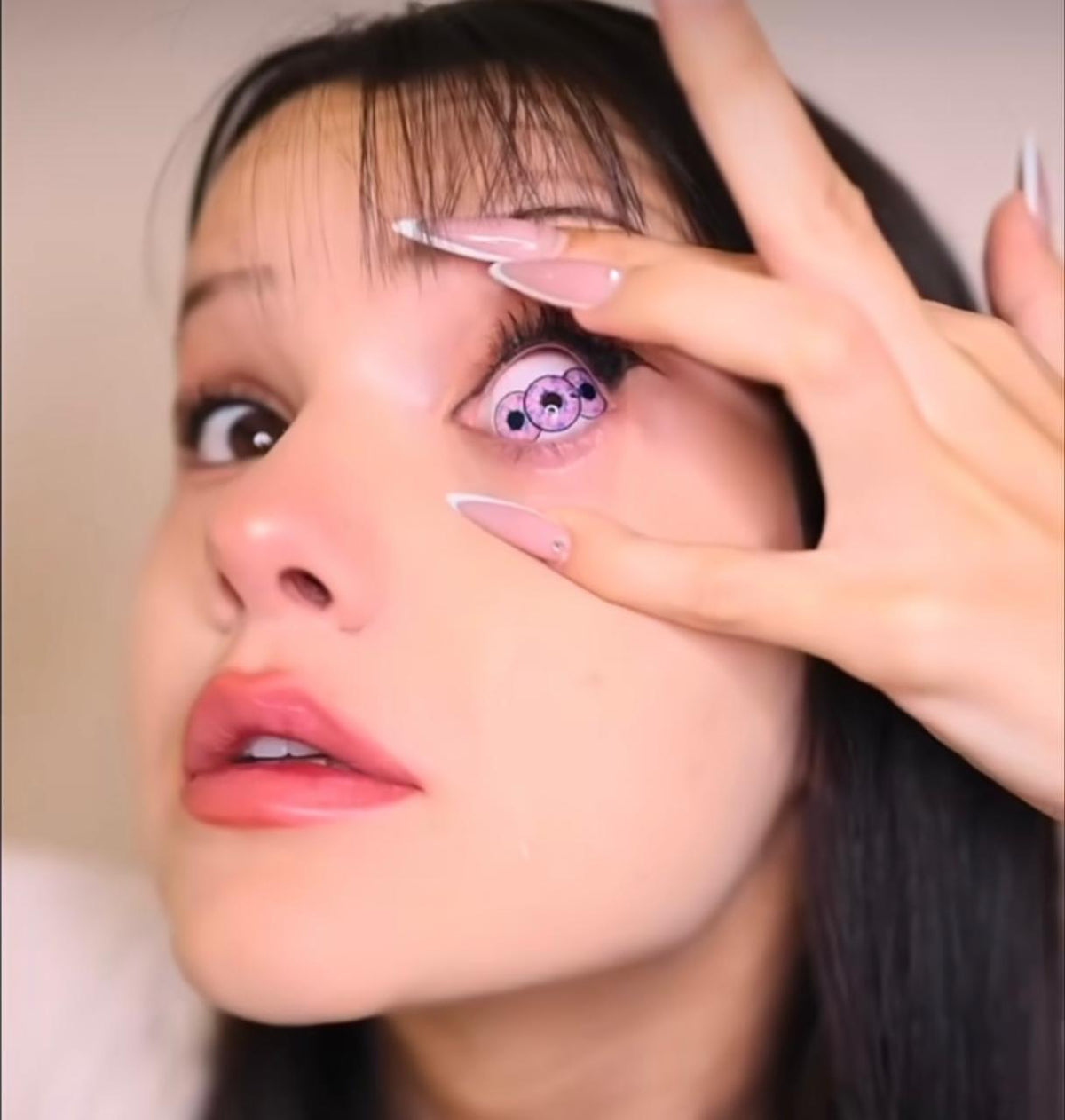 22 mm Sclera Triple Iris