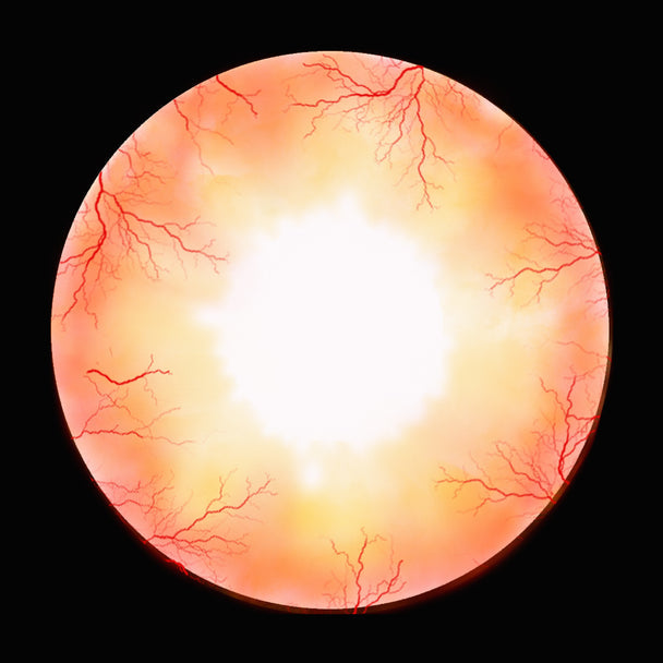 22 mm Ghost Sclera